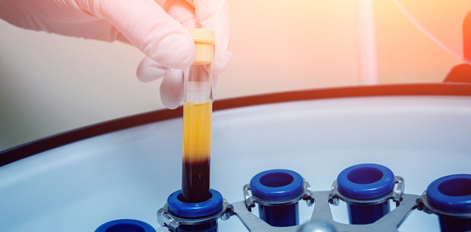 Blood Plasma Derivatives Market Seeking Excellent Growth with Bain Capital, Biotest, Octapharma